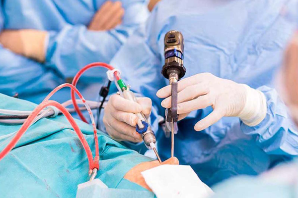 doctores realizando una cirugía de nariz en un paciente dentro de la sala de operación